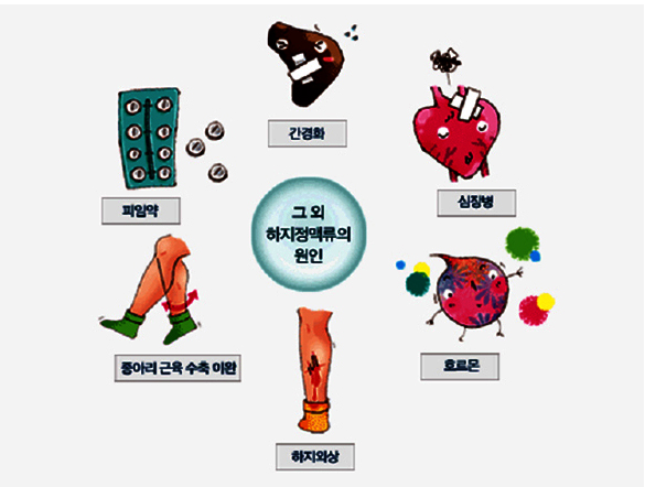 Cause infographic