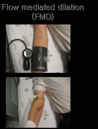 FMD 검사 실제 모습